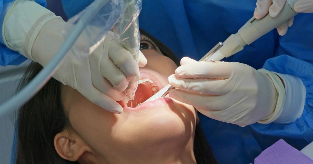 Oral Cancer Screening in Gorakhpur