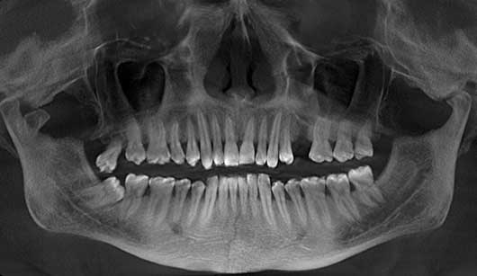 Expert Jaw Fracture Treatment in Gorakhpur – Quick Healing with Trusted Specialists