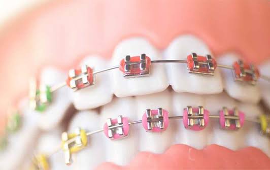 Cosmetic Dentistry in Gorakhpur