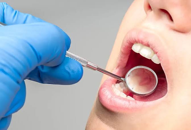 Dental Checkup in Gorakhpur
