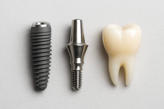 Dental Implants in Gorakhpur