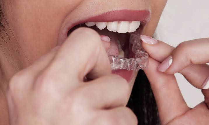 Gorakhpur Orthodontists