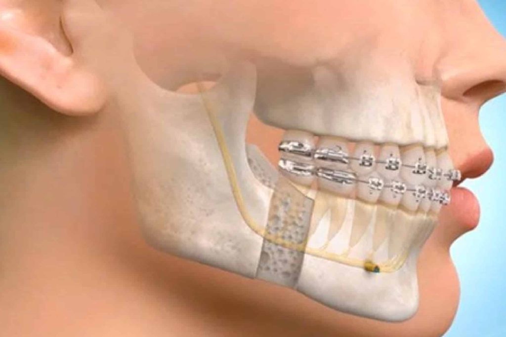 Oral and Maxillofacial Surgeon