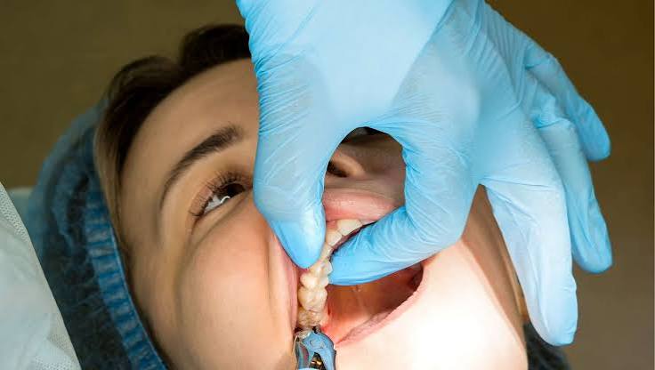 Recovery After Wisdom Tooth Removal