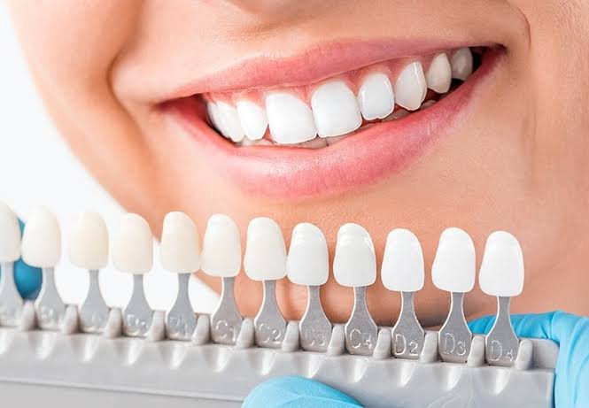 Zirconia Implants